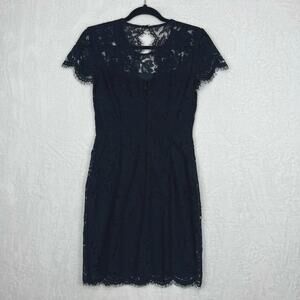 Banana Republic Loki Lace Dress Women Sz O Black NWT‎ Scalloped Hem Back Zip